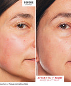 Skin Therapy - Multi-perfecting night oil serum 10 ML